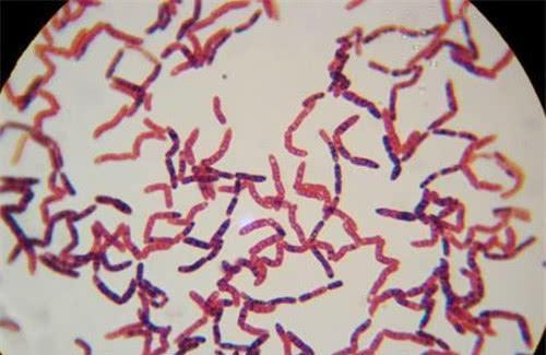 「科学家」科学家为永生，和女模特一起注射350万年前细菌，2年后意外发生了