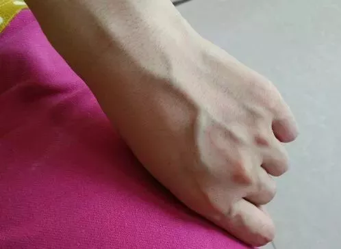 [牛肉]手上青筋越多，说明身体越.....