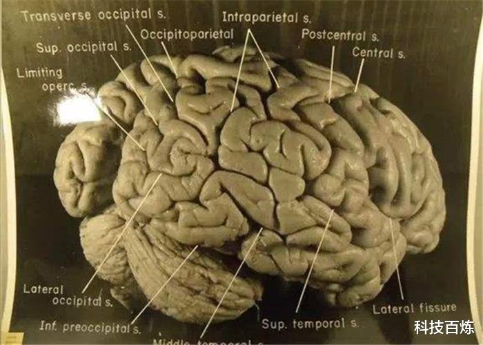 伽利略：为何要保留名人器官？伽利略的手指我忍了，爱迪生的气是什么鬼？