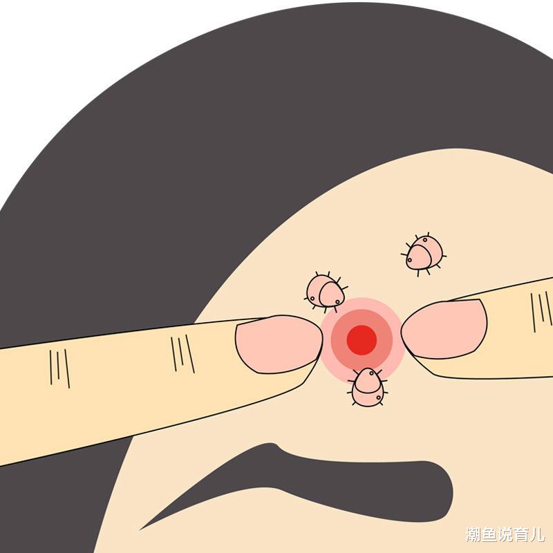 宫颈癌|17岁女孩眼睛长螨虫，视力将丧失。医生：大部分家庭都有这些元凶