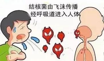结核病▲结核病:纠缠人类上千年,危害程度不亚于新冠肺炎