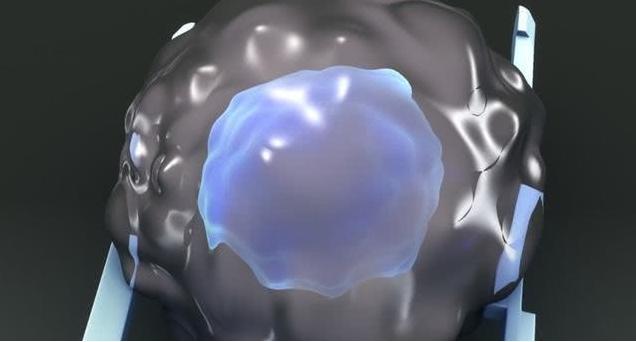 尿毒症@26岁女子确诊尿毒症,病情恶化,医生:都怪丈夫,不知克制!