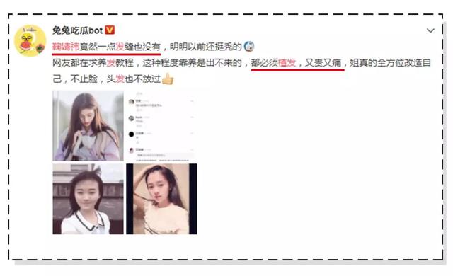 鞠婧祎■鞠婧祎是连头皮都整了?看到她头发缝那一刻,怀疑眼睛