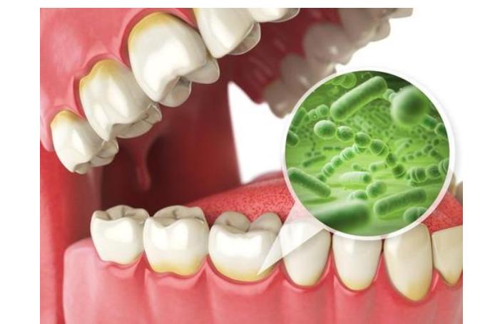 牙齿@牙齿上抠出来软软的黄泥,闻起来臭臭的?没你想的那么简单!