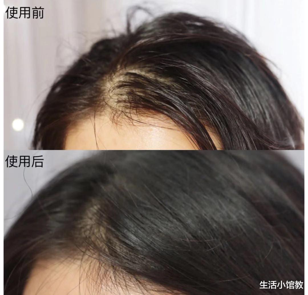 洗发水|央视点名以后：被拉入“黑名单”的洗发水，为何还是屡禁不止？