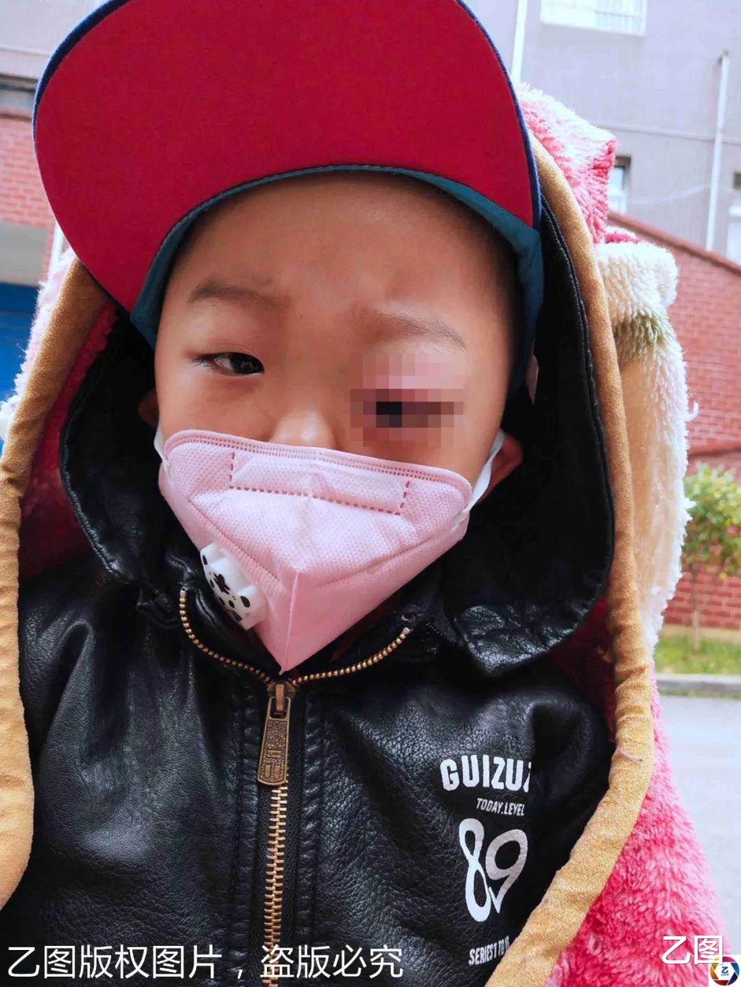 乙图|贵州7岁男孩一场病后眼睛上长了个“怪物”，每天喊痛，爸妈心碎