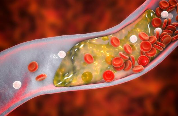 长寿|血管不堵的人,身体一般有5种特征,若你全占,恭喜,健康易长寿