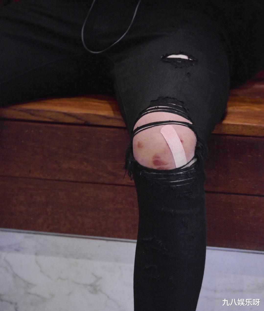 [王一博]王一博：镜头前光鲜亮丽，镜头后手背、膝盖、眼睛都是红的