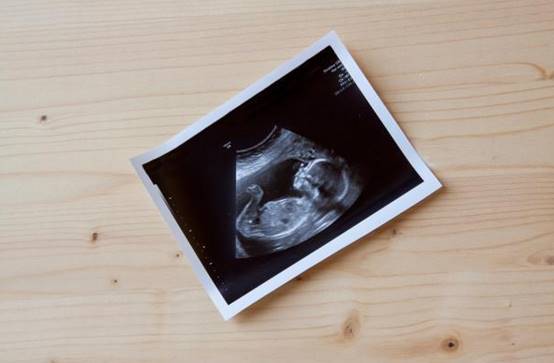 意大利突现“半人类”婴儿,专家警醒世人:人类需要重视!