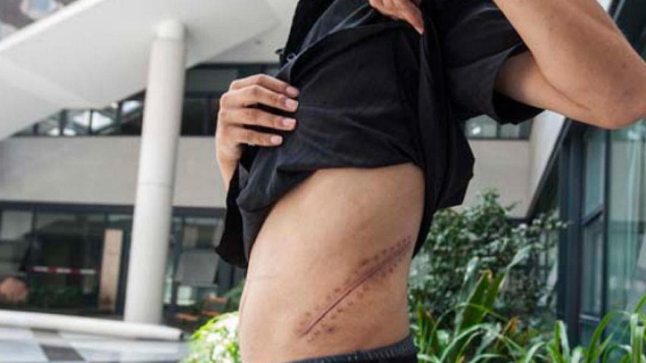 [王刚]8年前，那个卖肾买苹果手机的王刚，如今过得怎样？