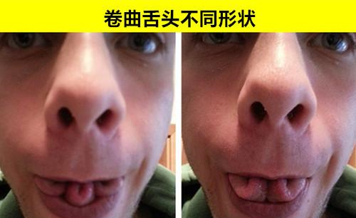 |研究发现：在世界上，只有少数人身体才会存在的10个罕见特征