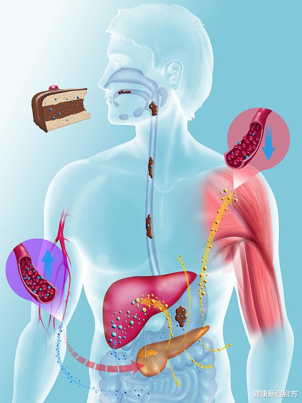 脂肪肝|“多吃3黄，少吃3白”坚持下去！脂肪肝，高尿酸跟你说拜拜！