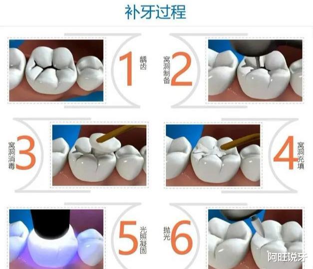 [疾控]虫牙不补可以自愈吗？