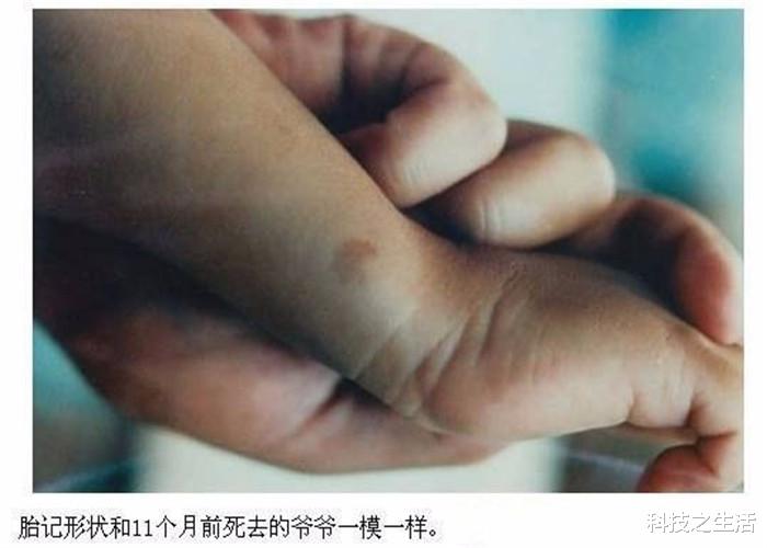 ##人类真的有轮回吗？据说我们身上的胎记，可能就是最好的证明！