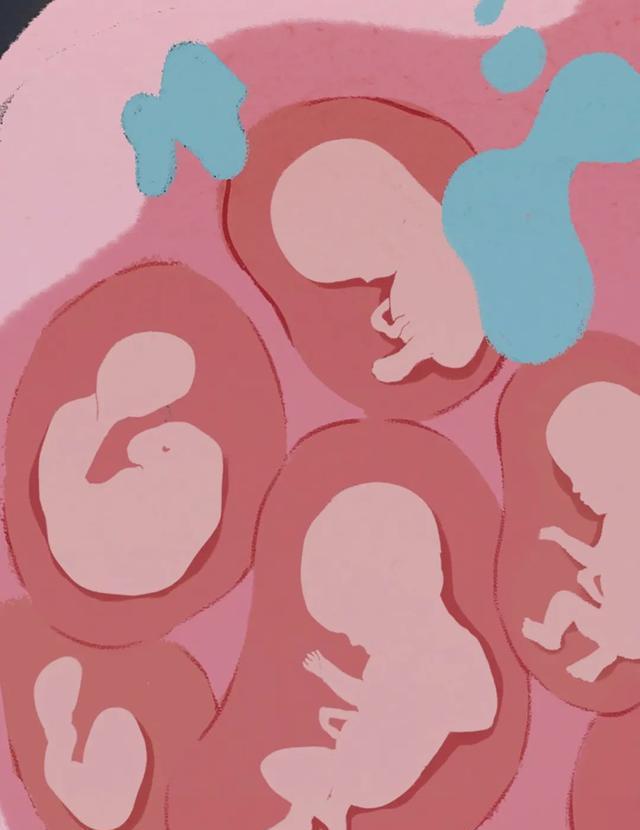 郑爽|为郑爽代孕的那个女子还好吗？