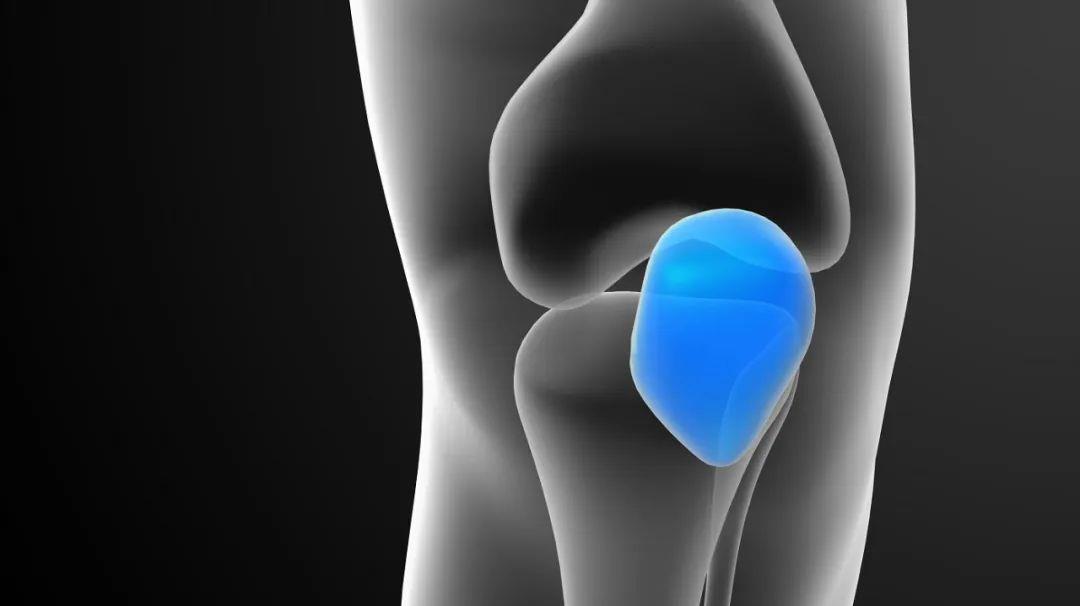 滑膜炎|真正的“护骨专家”是它，牛奶靠边站，你若爱喝，滑膜炎没了