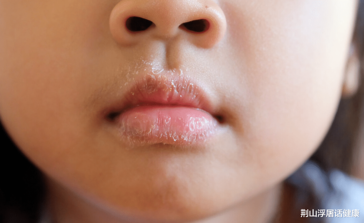 肝脏|若嘴巴出现这4个迹象，可能肝脏已“烂如筛网”，尽早自查