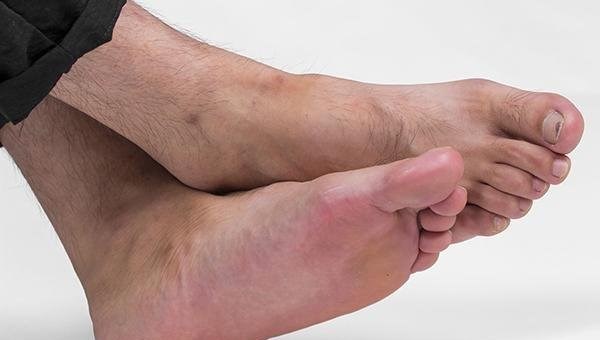 癌细胞|癌细胞不会突然转移，手脚频繁出现异象，可能是癌扩散了，多留意