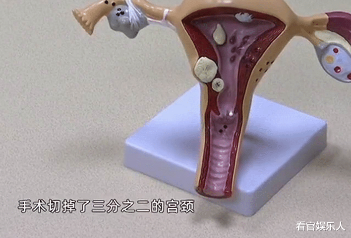 医生|24岁女子患上HPV病毒，医生问交往几个男友，竟然问到10个才点头