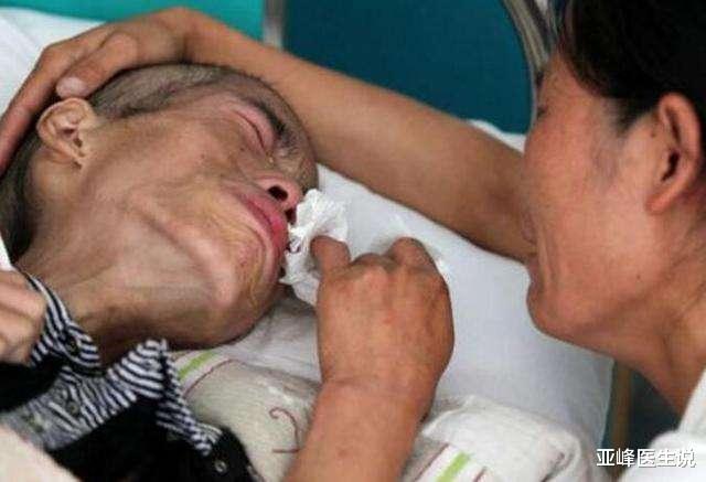 医生|肿瘤医生坦言：要想癌症痊愈，就得熬过3道“生死坎”