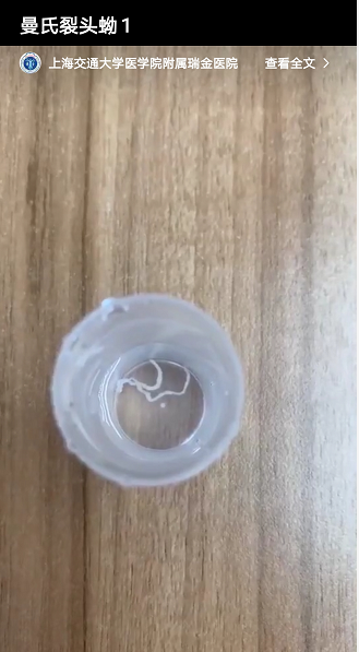 新民晚报|40岁上海男子皮下取出10厘米长活虫！可能因为吃了没煮熟的它