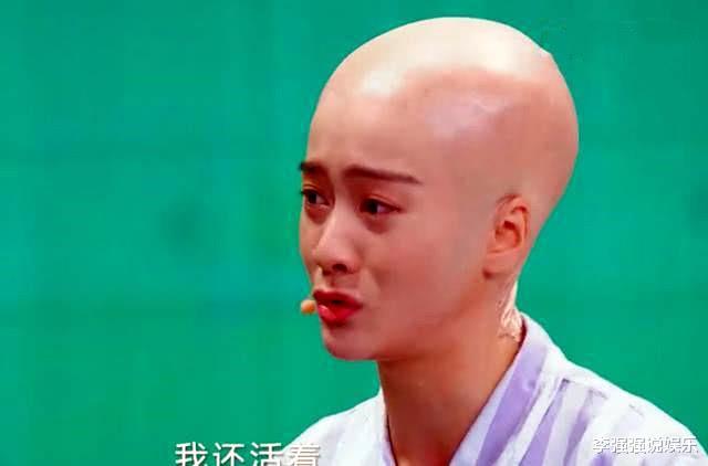 『郑爽』“丑不丑，看光头”，郑爽杨紫依旧漂亮，她简直是行走的卤蛋