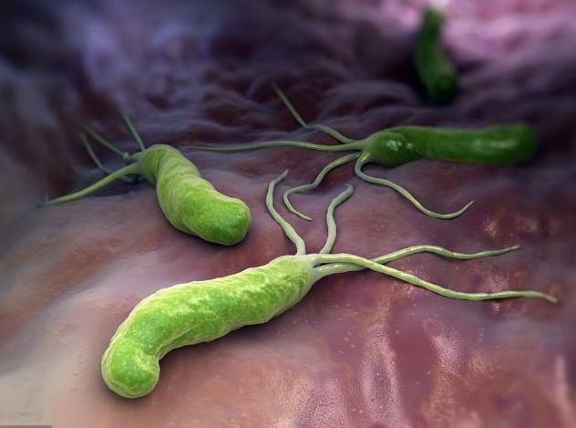 「胃癌」身体频繁出现4个表现,可能是胃癌“盯上”你了,尽早检查!