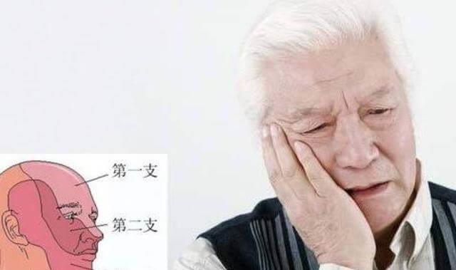 糖尿病▲别把三叉神经痛当成牙疼,牢记这3点,教你来分辨,这么做能预防