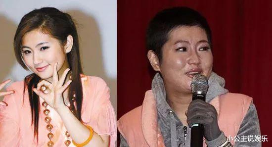 Selina|张承中娶了毁容的Selina，“暖男”背后却说：看她真的想吐