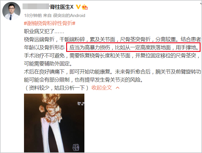 吴京|吴京晒谢楠桡骨钢钉照透露手术成功，调侃称骨头里的钢钉像金箍棒