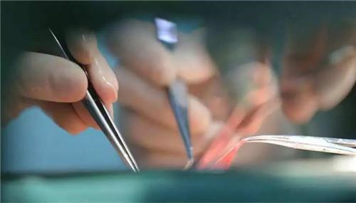 医生|36年前，美国女婴移植狒狒心脏后成功续命，最后她活了多久？