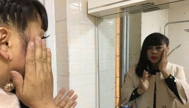 鸡蛋@肝不好，看脸就知道？牢记“4个字”，忌口2物，肝可能笑开颜