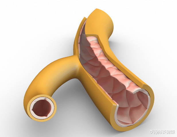 心血管疾病|男性ED，他达拉非能每天一次长期吃吗？要注意什么？一文说清