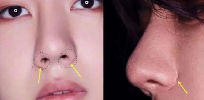 王一博|王一博《有翡》被退了？脸僵，近照疤痕明显被吐槽演技堪忧！