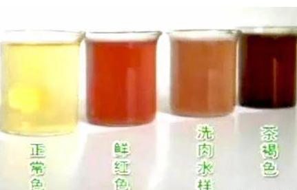 [红枣]28岁小伙半夜突发肾衰竭，医生叹气：1件事做的太多，竟也不忍忍