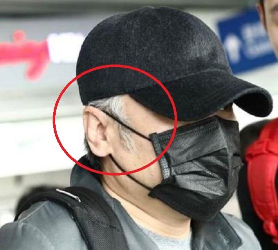 白发：白发出现在哪里“最危险”？白发生长的地方，暴露了身体隐患！