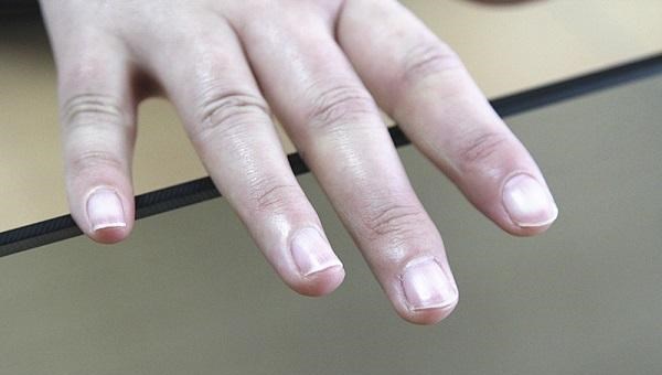 医生|医生惋惜：得了癌，手脚脸等多处部位都有提醒，可惜很多人不在意