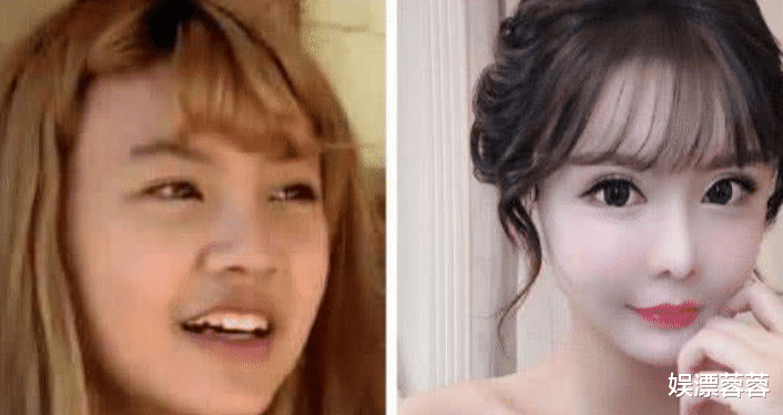 整容|?整容整毁了的5位明星红人， 正常人已无法欣赏你们的盛世美颜了！