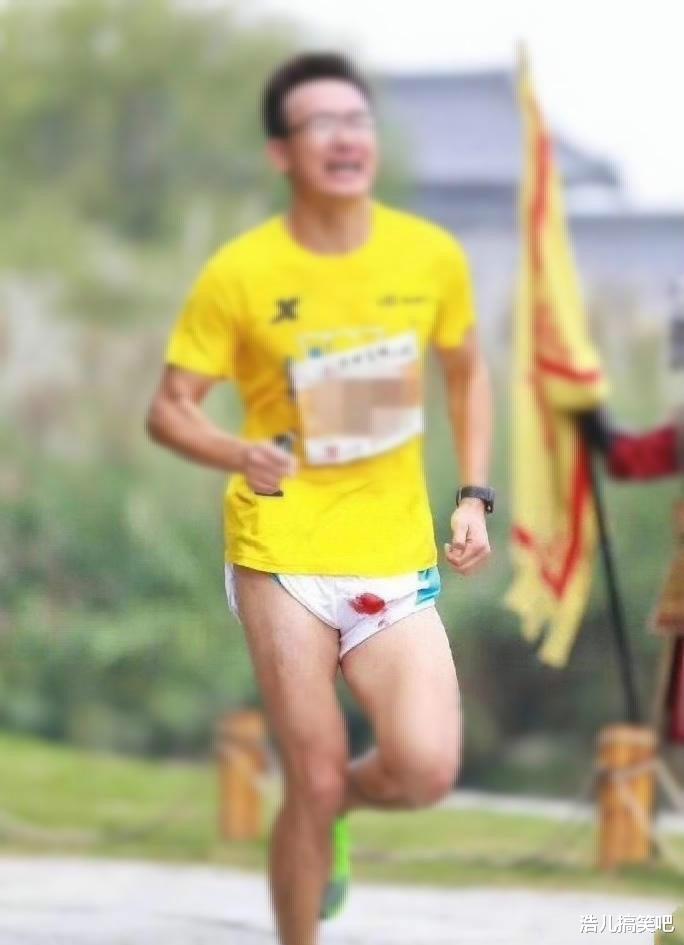 |一男子马拉松裤子摩擦磨破了,局部漏红了,大姐笑的好灿烂!哈哈哈