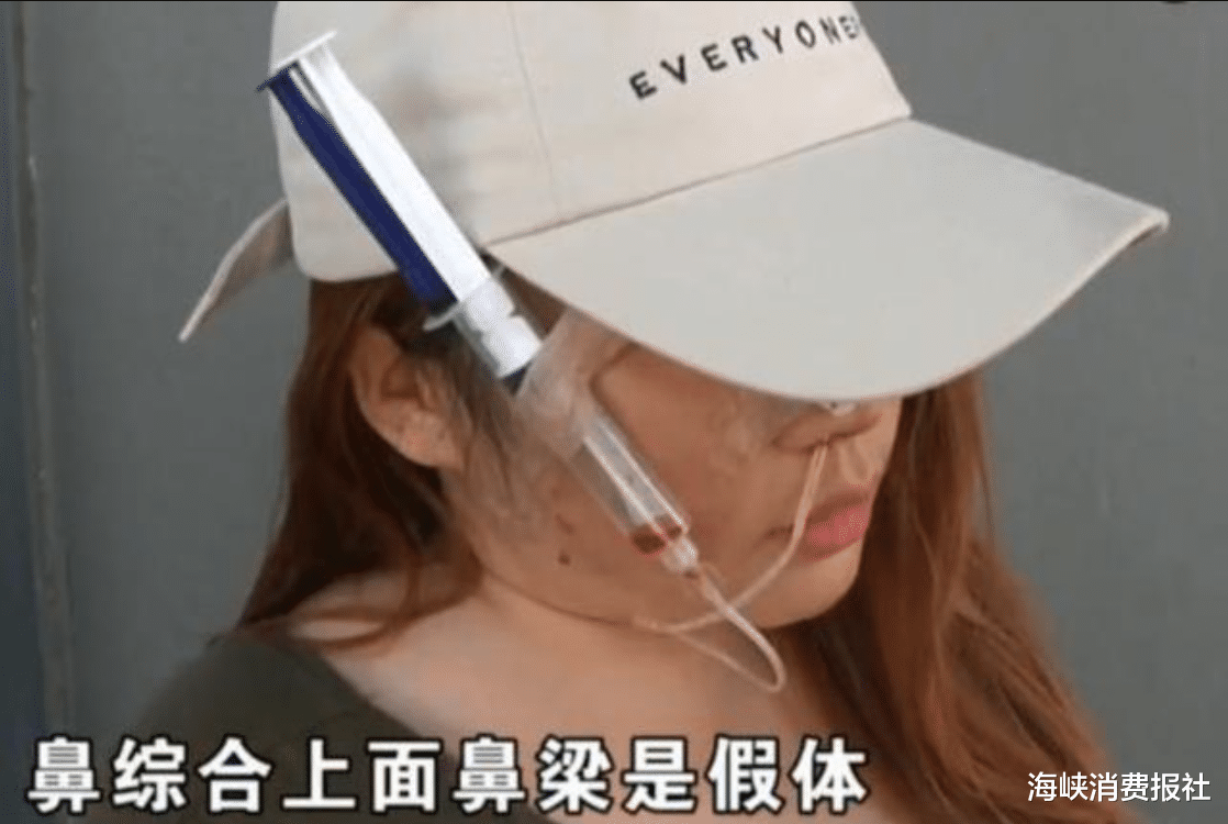 海峡消费报社|女子花6万整容，脸上天天挂着注射器，医院：赔你13000