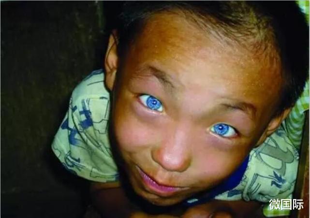 超能力|地球上真实存在5个超能力小孩，有人会读心术，有人眼睛就是X光