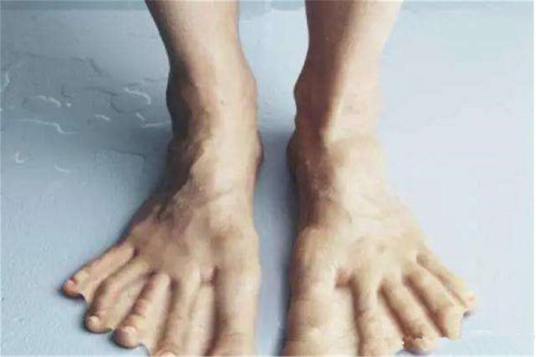 国籍|长期生活在海洋的巴瑶族，自幼刺破耳膜，未来会进化成鱼类生物吗