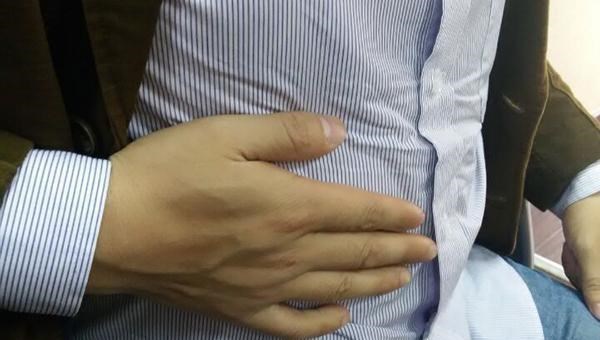 肝癌|肝癌是有预兆的，肝癌到访后，头部会出现异象，尽早检查别拖