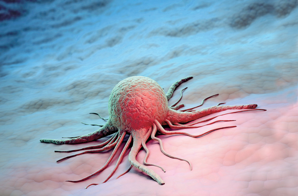 排毒|人怕癌，那癌怕啥？胃癌、肠癌、肝癌、肺癌都有克星，赶紧看一眼