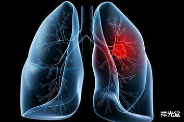 肺癌|肺病不能拖!脸上出现3个异常,或是肺癌亮出“红灯”,要早重视