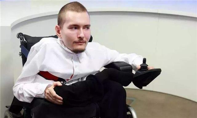 臆说古史|世界首例活人“换头”手术，俄罗斯程序员自愿参加，后来情况如何