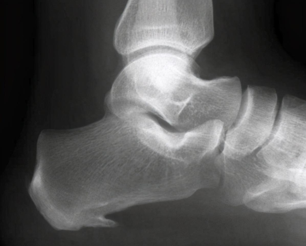 疾病|医生：这6种病根本无法完全治愈，说能根治的，就是想骗你的钱