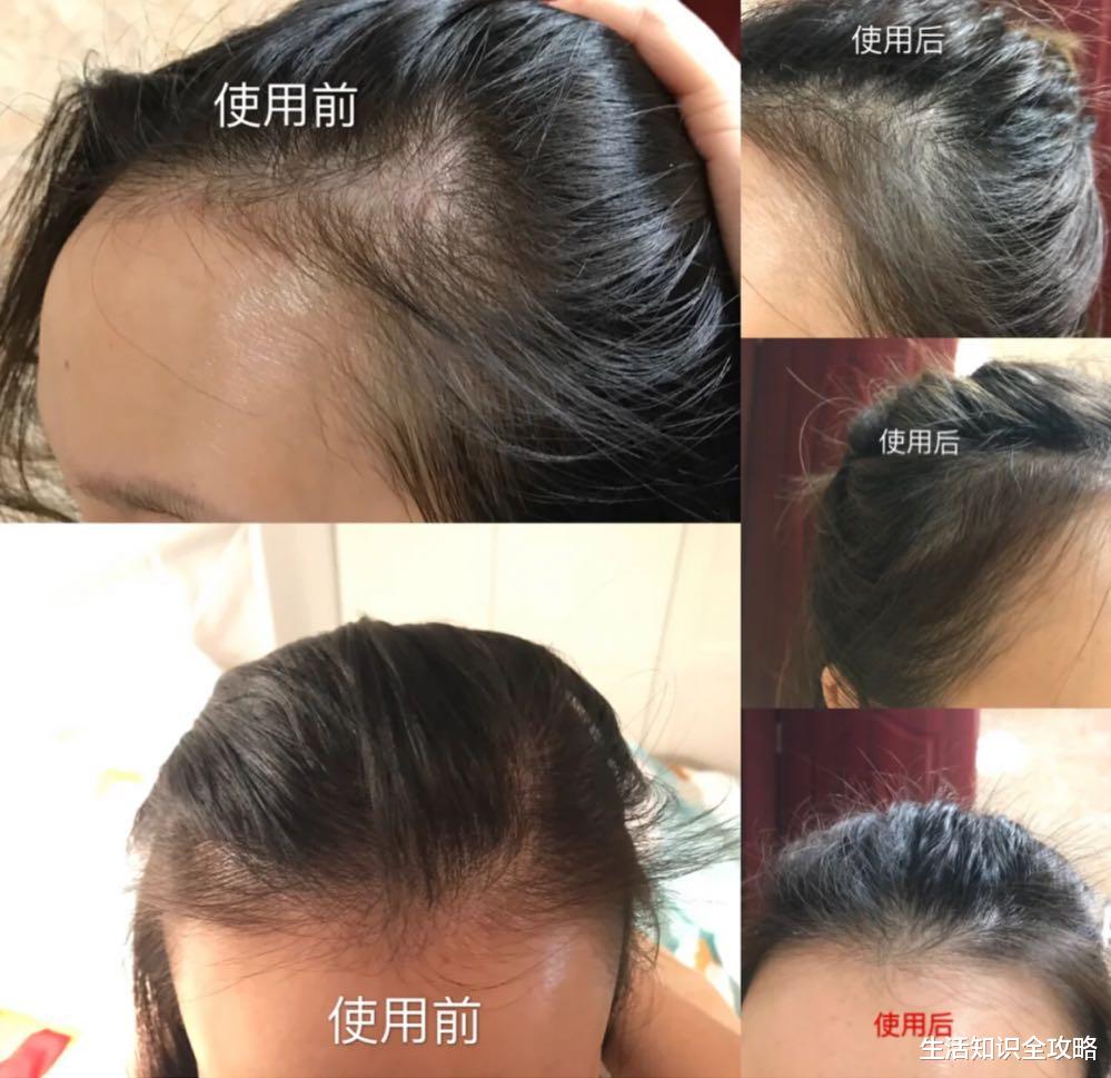 运动|列入黑名单的“致癌”洗发水，您使用过多少？快从家里丢掉吧