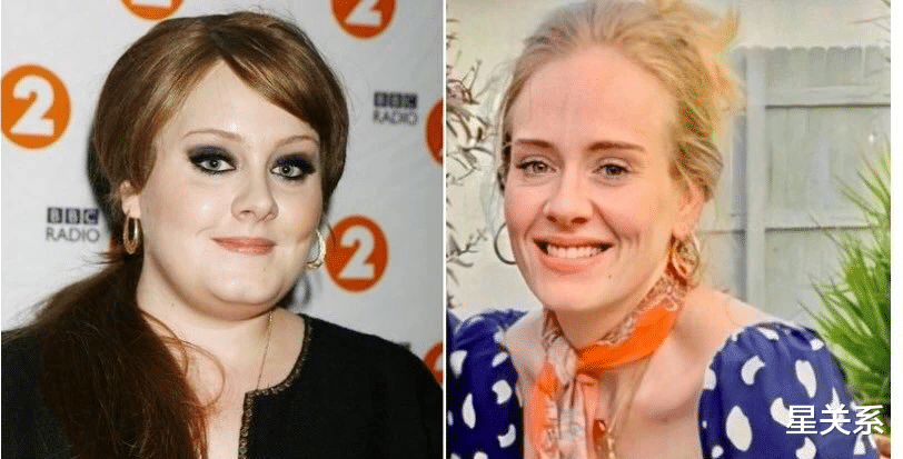 阿黛尔|阿黛尔与黑人歌手相恋后，暴瘦90斤满脸憔悴，她经历了什么？