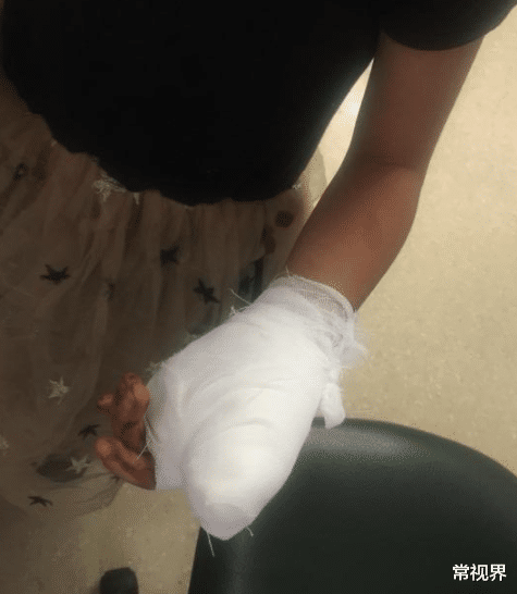 常视界|5岁女孩拇指被门夹断，妈妈的做法最终保住了孩子手指